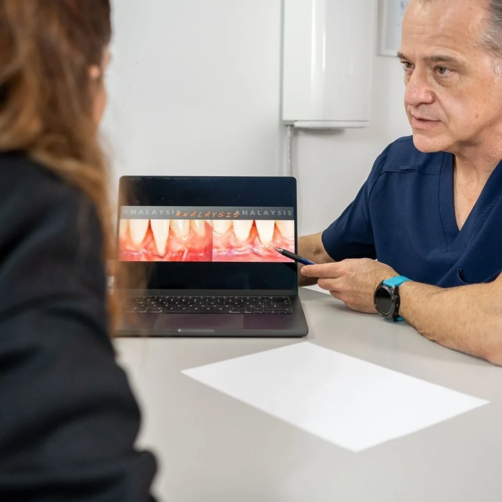 Cura della parodontite a Fiorano Modenese - casi prima e dopo - casi clinici studio dentistico a fiorano modenese - sorrisi prima e dopo