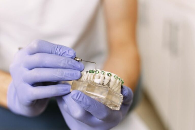 spostamento dei denti con l'apparecchio spostamento dei denti con l'apparecchio