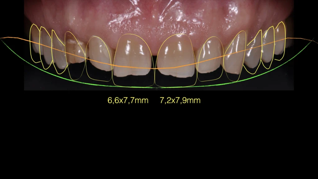 Studio Odontoiatrico Dott. Arioli Ezio - estetica dentale - digital smile design
